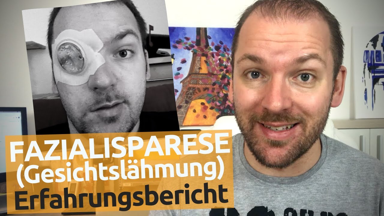 Was hilft gegen periphere Fazialisparese? Was hilft gegen periphere Fazialisparese?