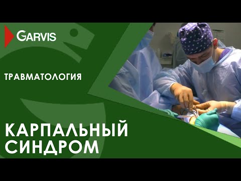 О лечении карпального канала: просто и доступно