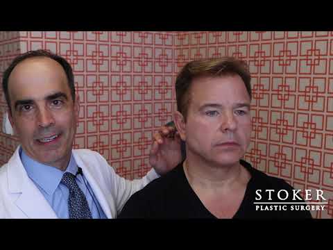 eyelid-surgery-los-angeles:-plastic-surgeon-dr.-david-stoker-reviews-male-facial-plastic-surgery