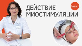 КАК действует МИОСТИМУЛЯЦИЯ?