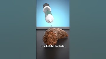 How A Poop Transplant Works 💩🤔 Surgeon Reacts