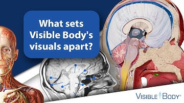 What sets Visible Body