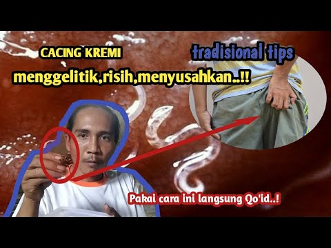 cacing kremi langsung Qo&rsquo;id gunakan cara ini~di jamin ampuh