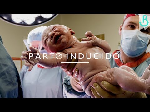 Video: ¿Cuándo se inducen los bebés atrasados?