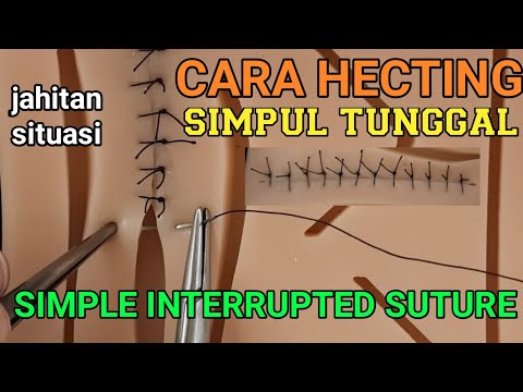 Video: Cara Menjahit Luka (dengan Gambar)