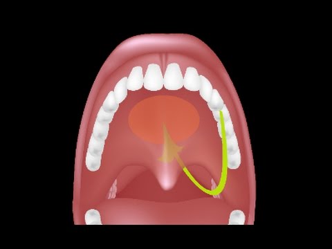 Adenoid Removal Surgery (Adenoidectomy)