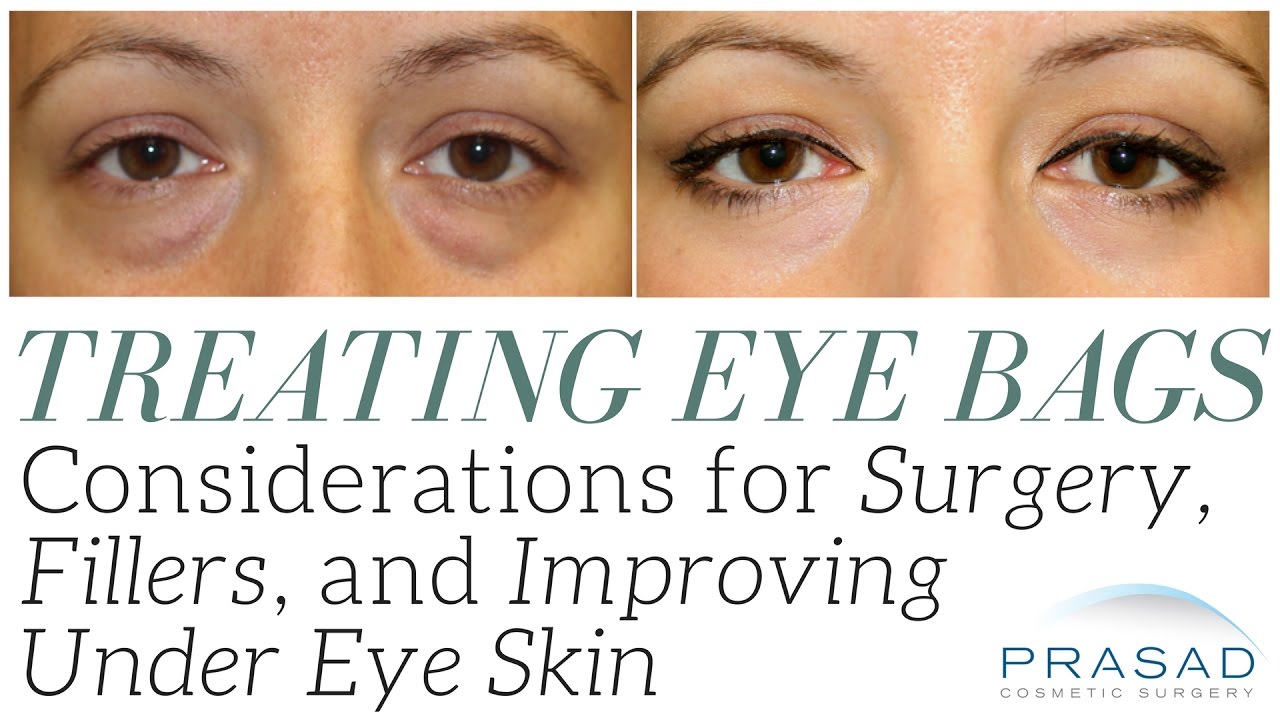 Download Under Eye Filler For Hollow Eyes Tear Troughs And Under Eye Bags Free Get Wallpaper Under Eye Filler For Hollow Eyes Tear Troughs And Under Eye Bags For Android