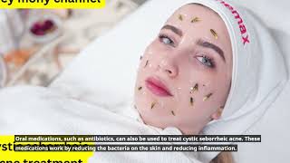 Cystic seborCystic seborrheic acne treatmentrheic acne treatment