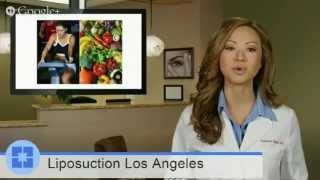 Liposuction Los Angeles | Dr. Cat Begovic (310) 272-5919