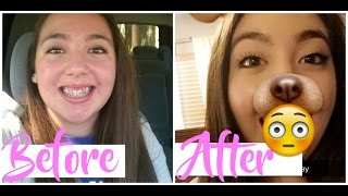 I GOT MY BRACES OFF!!