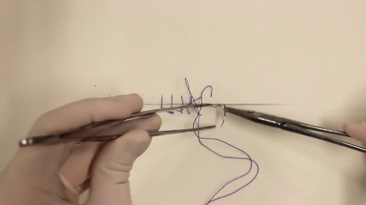 Curso de TOCE - 12 - Chuleio Ancorado