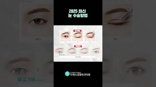 2025 최신 눈 수술방법
