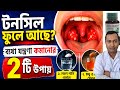 টনসিল লাল গলা ব্যথা অপারেশন করতে হবে সমাধান কি? টনসিলের সমস্যা এবং সমাধান