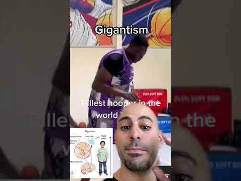 Video: Kokio ūgio yra gigantizmas?