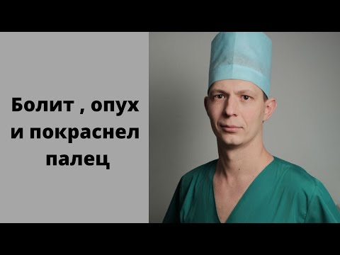 Панариций. Дергает и болит палец. Опух и покраснел. Что делать, куда обращаться?