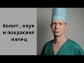 Панариций. Дергает и болит палец. Опух и покраснел. Что делать, куда обращаться?