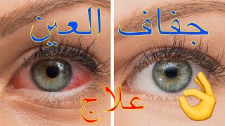 💧💧 طريقة بسيطة ولكن فعالة 👍🏻 لعلاج جفاف العين