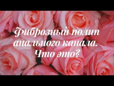 Фиброзный полип анального канала / Что это?