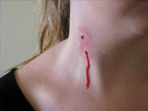 what do vampire bites look like what do vampire bites look like