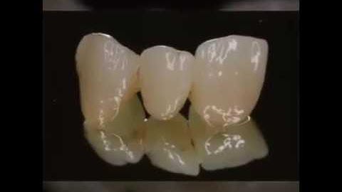 Ceramill Zolid FX Multilayer italiano