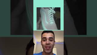 Crazy Optical Illusion