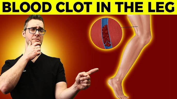 How does a blood clot pass from the leg to the lung? Anatomy