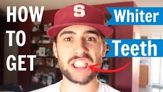 How To Get Whiter Teeth! | Smile Brilliant