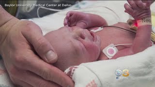 First Baby From A Uterus Transplant In The Us Born In Dallas