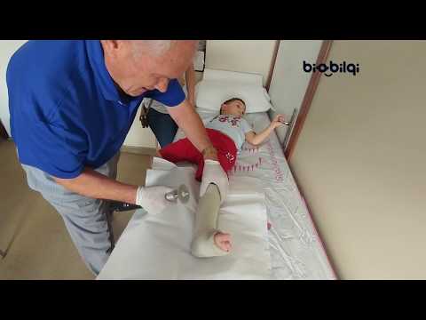 Video: Bir çocuğun Bacaklarının Ve Kollarının Alçıları Nasıl Alınır?
