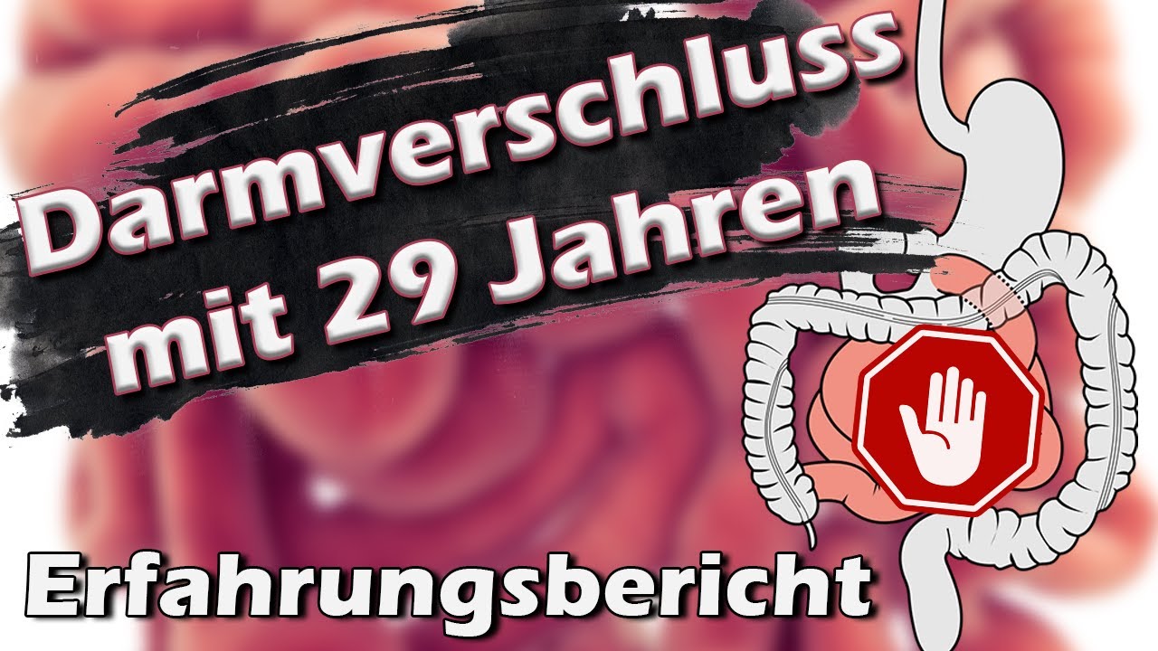 Darmverschluss Wie Lange Bis Zum Tod www.youtube.com