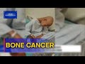 Mukha ng Balita | 11-anyos nadiskubreng may bone cancer nang mauntog ang tuhod