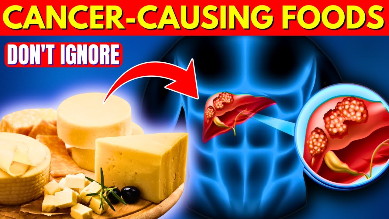 Avoid These 9 Foods For A Healthier Liver YouTube