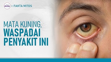 Penyebab Mata Kuning yang Harus Diwaspadai | Hidup Sehat tvOne