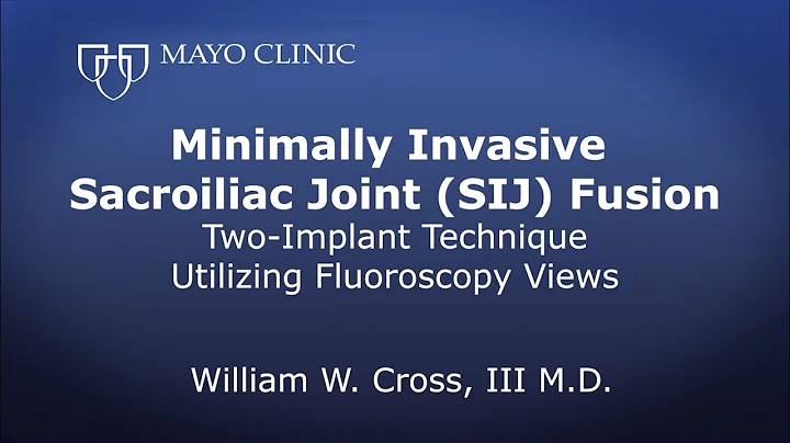 Minimally Invasive Sacroiliac Joint (SIJ) Fusion T...