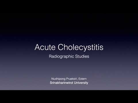 Acute Cholecystitis - Radiographic Studies