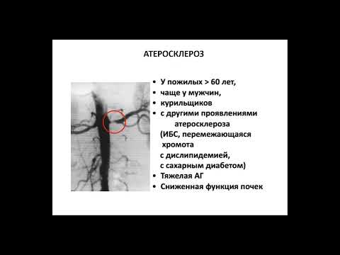 13:50 Вторичные(Симптоматические) артериальные  гипертензии