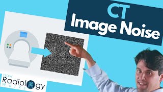 CT Image Noise (Dependence on Technical parameters)