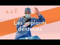 Le A a Z: Les implants dentaires ! Prix, procédure, avantages...