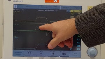 Servo i Skill 6a e PRVC changes in compliance