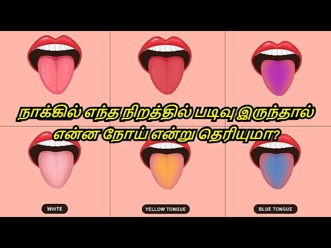 how the colour of your tongue reveals your health in tamil signs tongue color chart