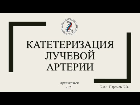 Катетеризация лучевой артерии