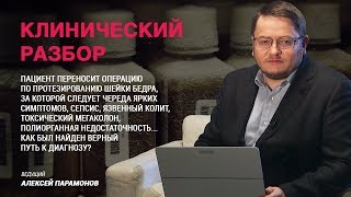 Параллельные истории Параллельные истории