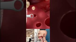 Asmr Remove Foreign Objects From The Throat
