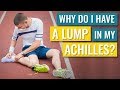 Why do I have a lump in my Achilles tendon?