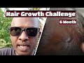 Rs0  husband hair growth challenges by wife  no language  thavam