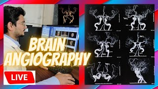 Live CT Scan Of Brain Angiography| Scanning and processing technique #radiologytechnologist #ctscan screenshot 4