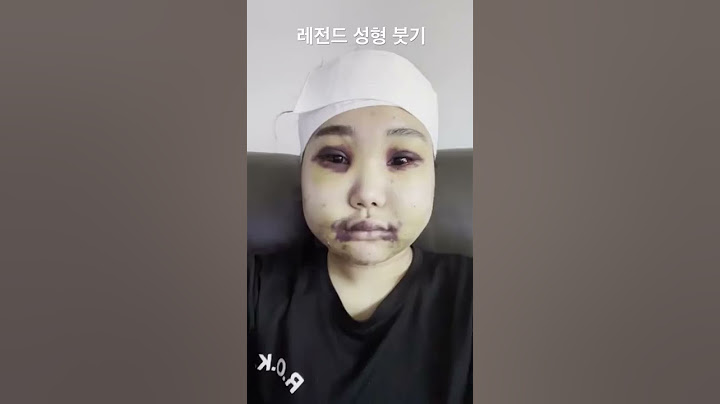 놀라 자빠지는 성형 전후 #shorts