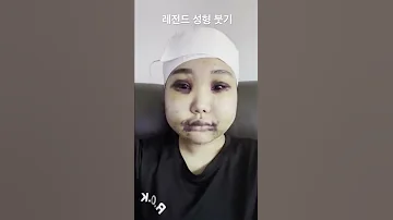 놀라 자빠지는 성형 전후 Shorts 