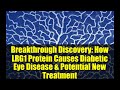 Breakthrough Discovery: How LRG1 Protein Causes Diabetic Eye Disease & Potential New Treatment