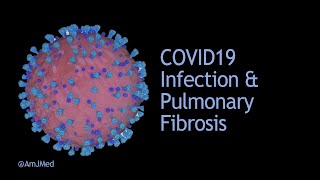 COVID19 Infection & Pulmonary Fibrosis